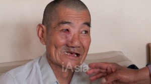 「歯が抜ける村」中国レアアース汚染の実態　上