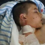 ＜シリア＞トルコ軍・武装諸派の攻撃続く北西部アフリン（2）医師足らぬ病院（写真5枚）