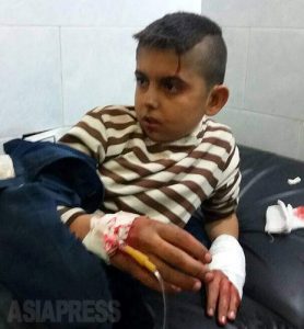 <シリア内部>トルコ軍・武装諸派の攻撃続くアフリン(8) 住民死傷者850人超「もし生きていたら また連絡します」と住民 (写真4枚+地図)