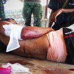 ミャンマー内戦4年　解放区潜入1ヵ月　タイ国境・カレンニー州からの報告（3）取材中、国軍のドローン兵器に爆撃される　抵抗勢力はドローン兵器に対処できず