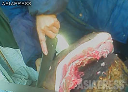 Pork on the chopping board, seen here complete with skin. The seller will usually prepare the portions according to the customer's orders.(November2012. Taken in the northern border city) ASIAPRESS